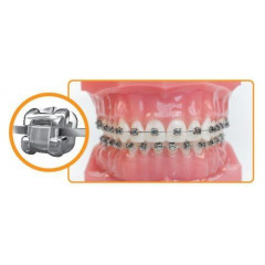 Брекети для вирівнюван зубів саморегулюючі Damon Q Ormco (США)