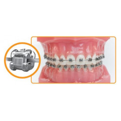 Брекети для вирівнюван зубів саморегулюючі Damon Q Ormco (США)