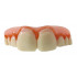 Graftobian Novelty Teeth Billy Bob MEGABUCKS - Overdenture teeth