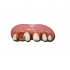 Graftobian Novelty Teeth Billy Bob HUNTIN Overdentures